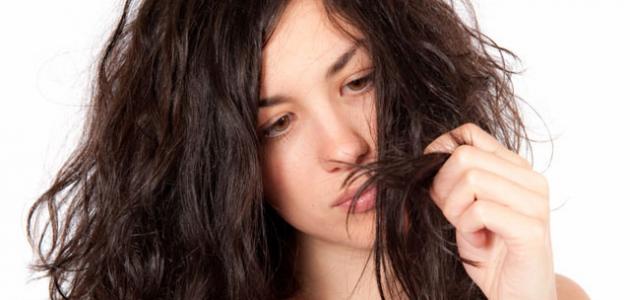 علاج تساقط الشعر الدهني الشديد